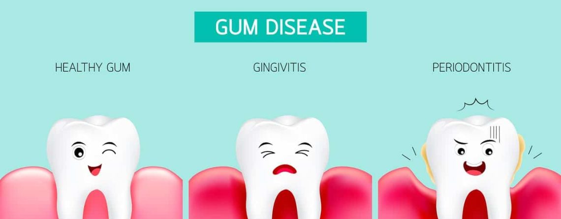 gum disease